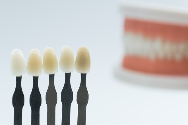 Common Dental Veneer Myths, Debunked