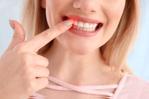 Benefits Of Gum Disease Treatment From A Dentist